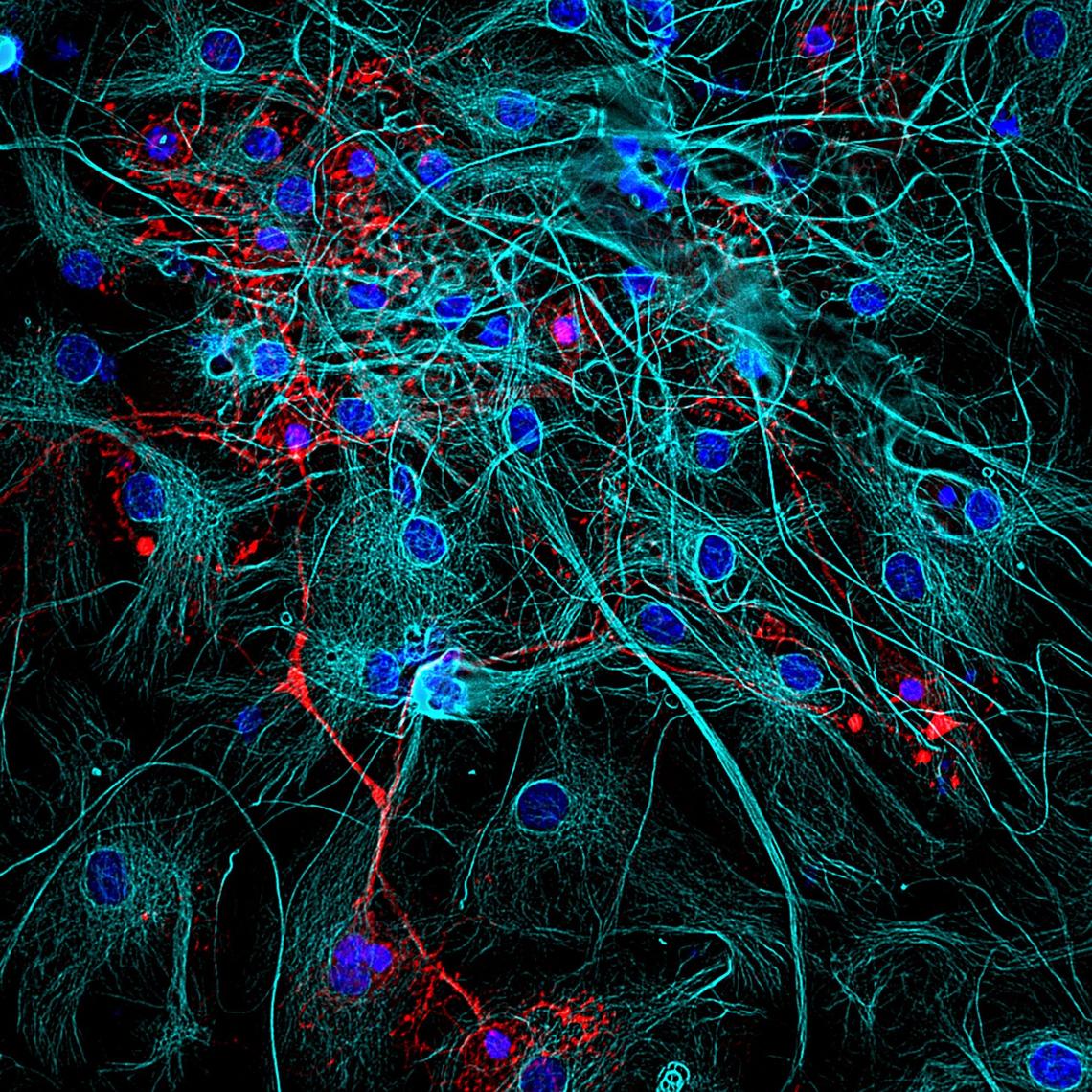 Computational Tools for Target Identification